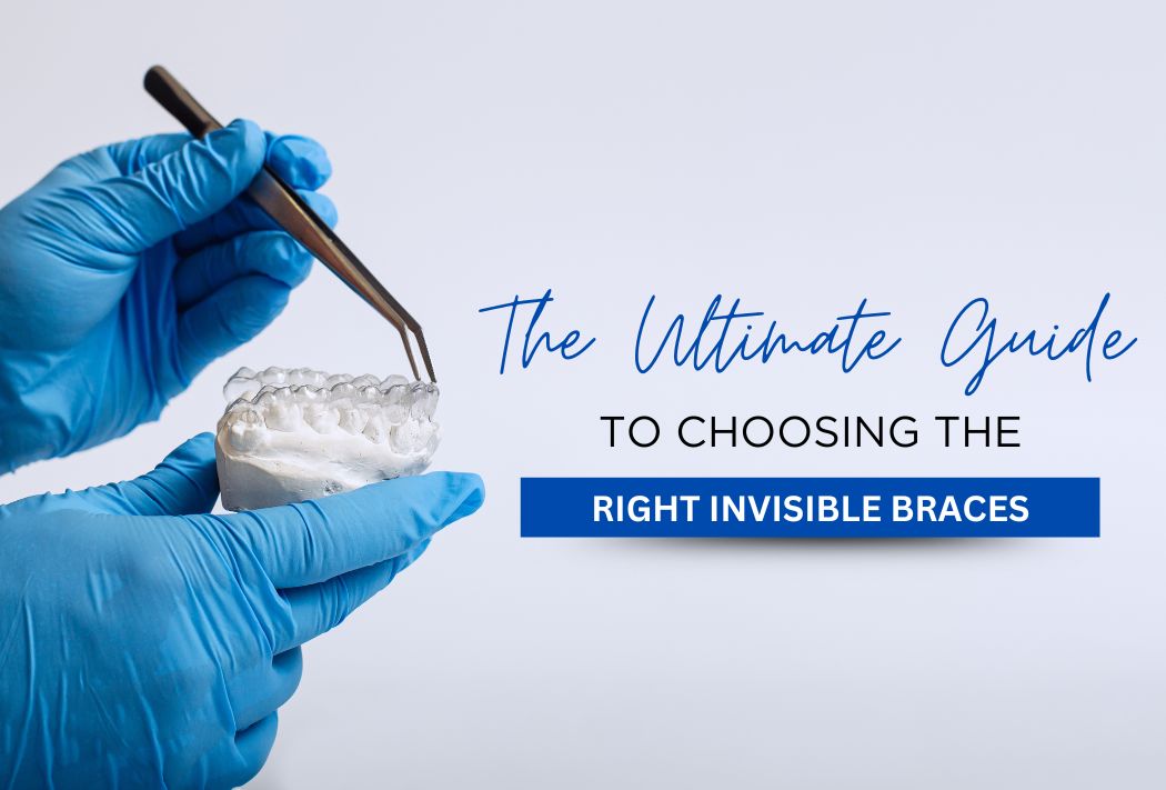 The Ultimate Guide to choosing the right invisible braces